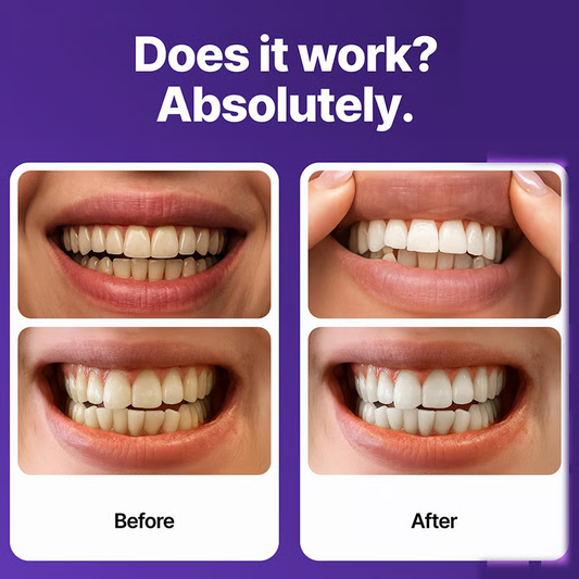 Dreamova Enamel Whitening Strips