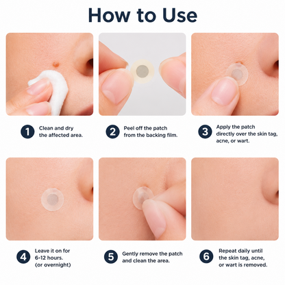 ⏰Ends Today: 60% OFF✨2-in-1 Microneedle & Hydrocolloid Patch | Removes Raised Moles, Acne, Flat Warts & Skin Tags -8RH7