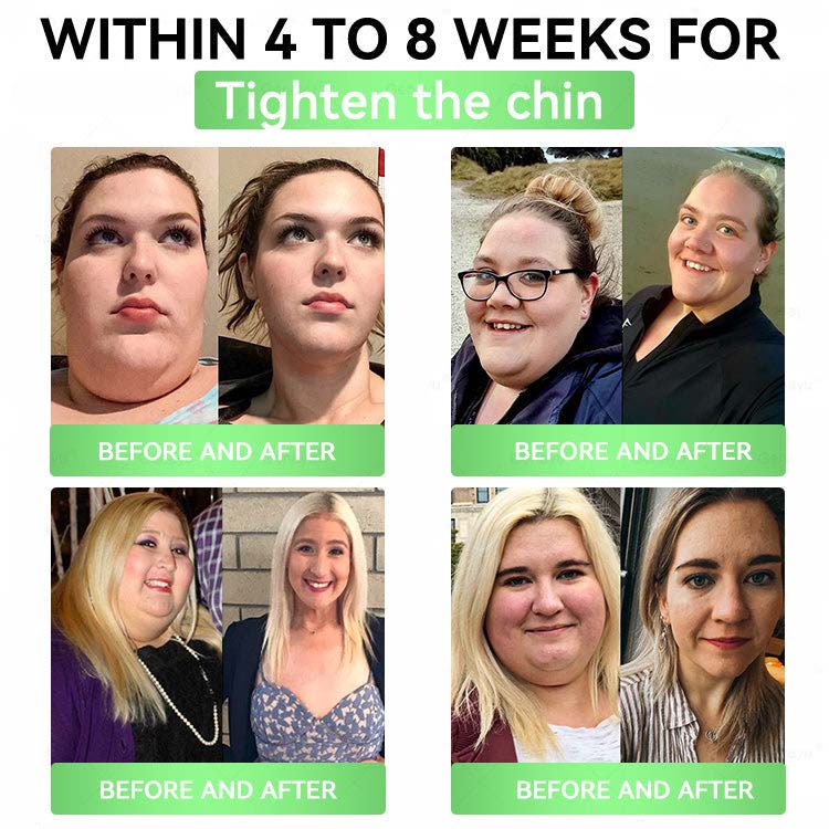 🔥Official Store| 🧑‍⚕️Alcuras™ Moringa × Berberine × AMPK 8-Benefit Slimming & Metabolic Nano Microneedle Patch 🇺🇸  Just once a day · Visible changes in 7 days  ✅ For obesity, loose skin, diabetes, sleep apnea, joint issues, and more🔥🔥