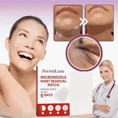 Microneedle Skin Tag Patch - 14-Day Clear Skin