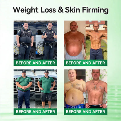 🔥Official Store| 🧑‍⚕️Alcuras™ Moringa × Berberine × AMPK 8-Benefit Slimming & Metabolic Nano Microneedle Patch 🇺🇸  Just once a day · Visible changes in 7 days  ✅ For obesity, loose skin, diabetes, sleep apnea, joint issues, and more🔥🔥