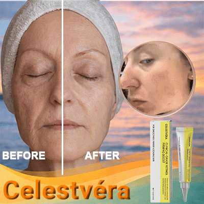 Lift & Smooth Anti-Wrinkle Cream - 50% Off Offer