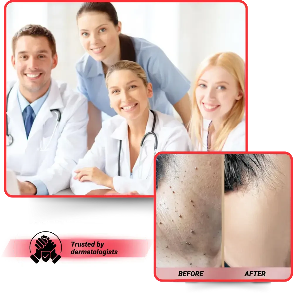 Microneedle Skin Tag Patch - 14-Day Clear Skin