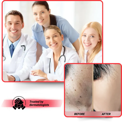 Microneedle Skin Tag Patch - 14-Day Clear Skin